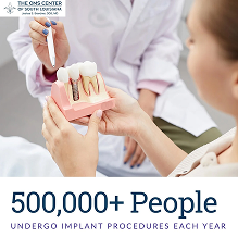 Dental implant procedures demonstration and statistics.